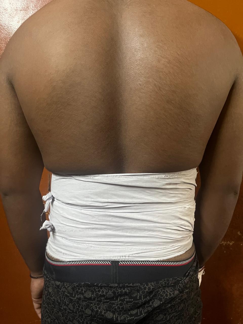Back Bandage